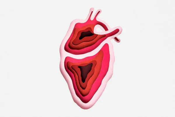 Hypokinesis Heart