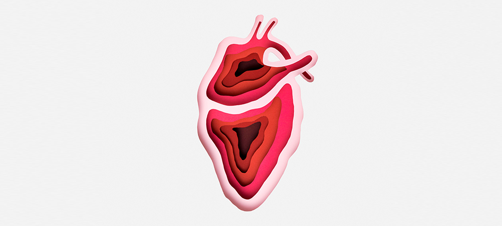 Hypokinesis Heart