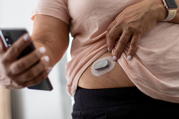 CGM for Weight Loss