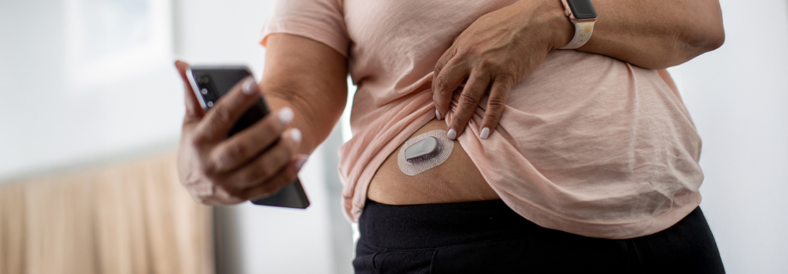 CGM for Weight Loss