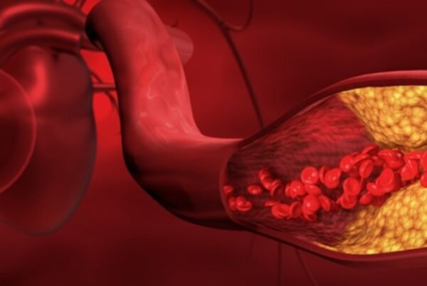 Renovascular Hypertension